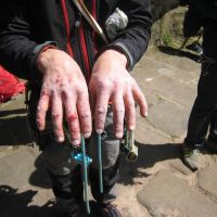 The Presidential hands after 2 days (and half a night) on grit (Roger Dyke)